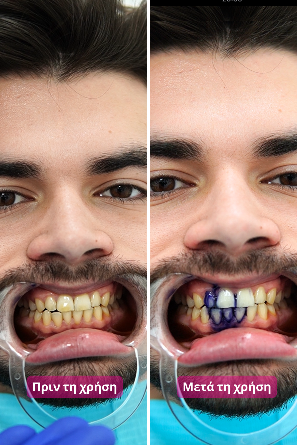 Διορθωτής Χρώματος Buencia V34