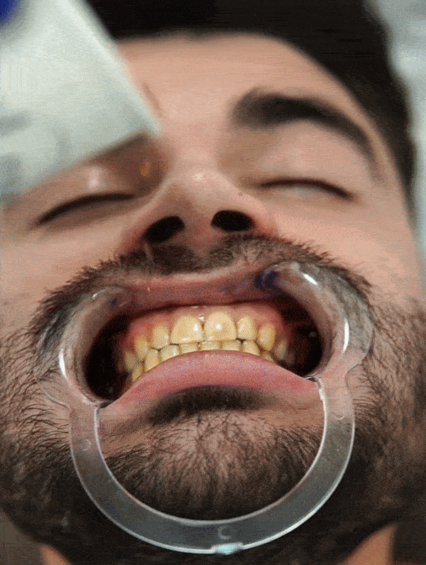 Διορθωτής Χρώματος Buencia V34